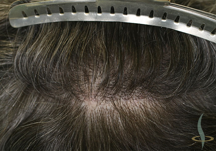 منطقة الاقتطاف